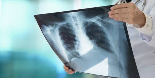 Exámenes relacionado con enfermedades respiratorias crónicas