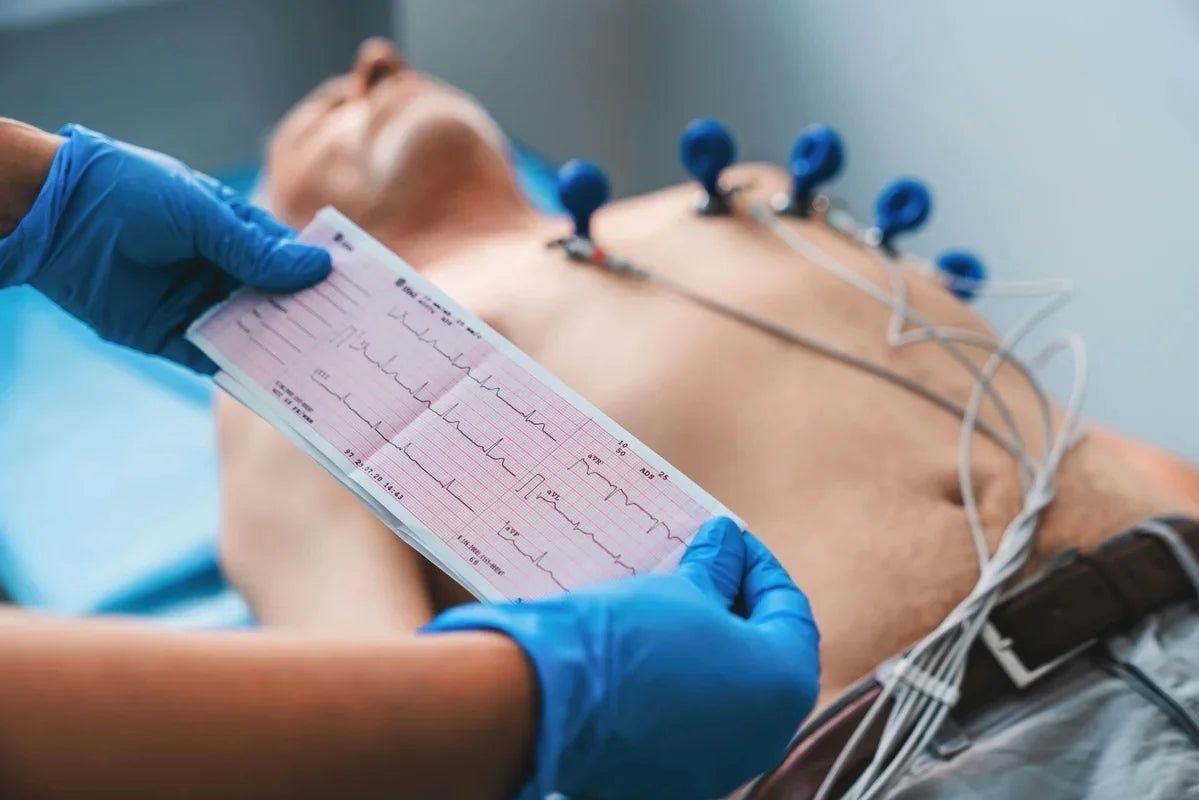 Electrocardiograma